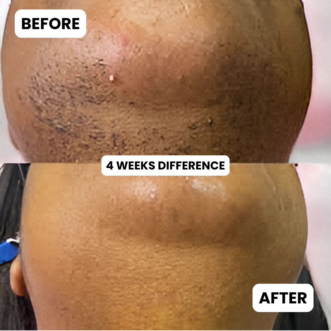 Facial Hair Freedom Oil