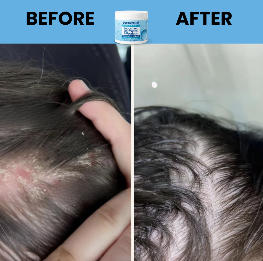 DermaRelief Cream