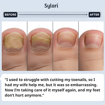 Sylari Antifungal Pen