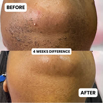 Facial Hair Freedom Oil