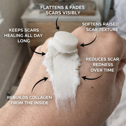 Sylari - Silicone Scar Care Stick