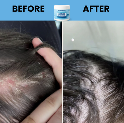 DermaRelief Cream